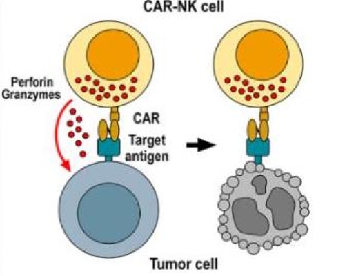 CAR-NK細胞