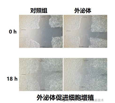 促進(jìn)細(xì)胞生長(zhǎng)